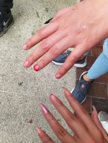 Estudiantes de la ULA agredidos