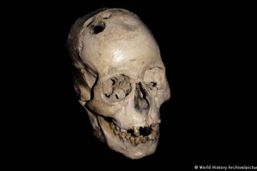Trepanaciones edad de bronce