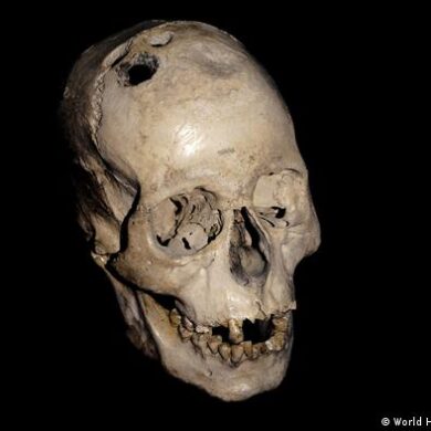 Trepanaciones edad de bronce