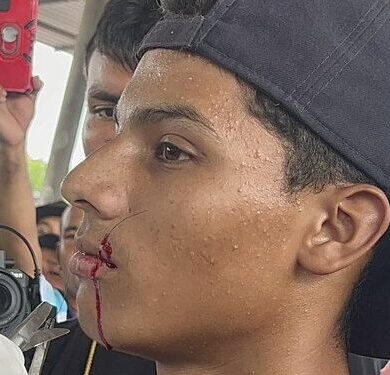 LABIOS